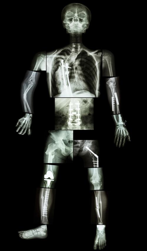 Cinco partes del cuerpo humano que no sirven para nada-0